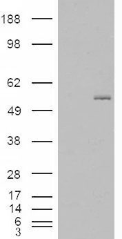 Anti-GCNT3 antibody, Internal used in Western blot. GTX88863