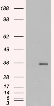 Anti-GDF15 antibody, C-term used in Western blot. GTX89503