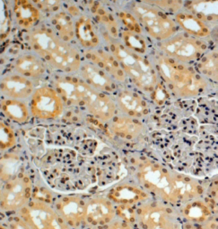 Anti-GERP / TRIM8 antibody, C-term used in IHC (Formalin-fixed paraffin-embedded sections). GTX89824