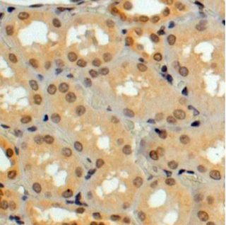 Anti-GERP / TRIM8 antibody, C-term used in IHC (Formalin-fixed paraffin-embedded sections). GTX89824