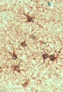 Anti-GFAP antibody, C-term used in IHC (Formalin-fixed paraffin-embedded sections). GTX89226
