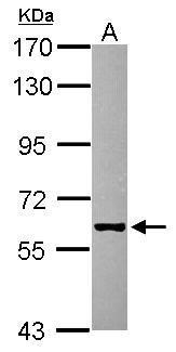 Anti-GHDC antibody [N1C2] used in Western blot. GTX119239