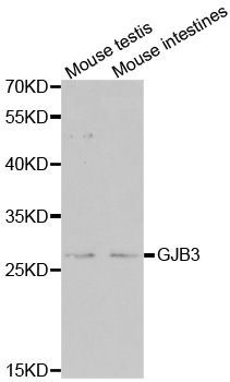Anti-GJB3 antibody used in Western blot. GTX54127