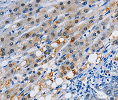 Anti-GJB3 antibody used in IHC (Formalin-fixed paraffin-embedded sections). GTX54127