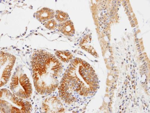 Anti-GLOD4 antibody [N1C3] used in IHC (Formalin-fixed paraffin-embedded sections). GTX104484