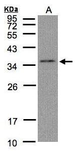 Anti-GLOD4 antibody [N1C3] used in Western blot. GTX104484