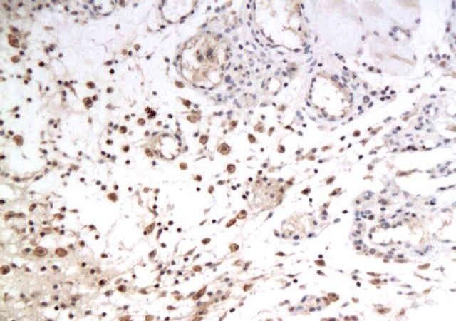 Anti-GLUT12 antibody used in IHC (Formalin-fixed paraffin-embedded sections). GTX37419