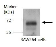 Anti-Glutaminase antibody [C1C3] used in Western blot. GTX114982