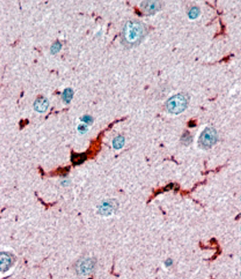 Anti-Glutathione Peroxidase 1 (iso1) antibody, Internal used in IHC (Formalin-fixed paraffin-embedded sections). GTX89328