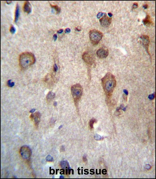 Anti-Glycoprotein hormone beta 5 antibody used in Immunohistochemistry. GTX53557