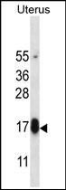 Anti-Glycoprotein hormone beta 5 antibody used in Western blot. GTX53557