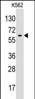 Anti-Glypican 6 / GPC6 antibody, N-term used in Western blot. GTX81897