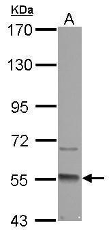 Anti-GMCL1 antibody [C1C3] used in Western blot. GTX116759
