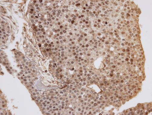 Anti-GOLGA6B antibody [C2], C-term used in IHC (Formalin-fixed paraffin-embedded sections). GTX107707
