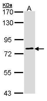 Anti-GOLGA6B antibody [C2], C-term used in Western blot. GTX107707