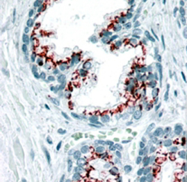 Anti-GOLPH2 antibody, C-term used in IHC (Formalin-fixed paraffin-embedded sections). GTX89715