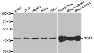 Anti-GOT1 antibody used in Western blot. GTX54155