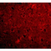 Anti-GPAT1 antibody used in ICC/IF. GTX85034