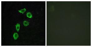 Anti-GPR123 antibody used in ICC/IF. GTX87866