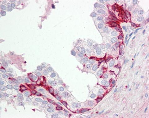 Anti-GPR55 antibody [C2C3], C-term used in IHC (Formalin-fixed paraffin-embedded sections). GTX100375