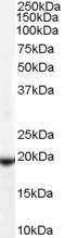 Anti-GPX4 (Isoform a and c) antibody, C-term used in Western blot. GTX89281