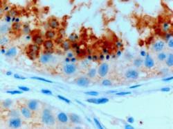 Anti-GPX4 (Isoform a and c) antibody, C-term used in IHC (Formalin-fixed paraffin-embedded sections). GTX89281