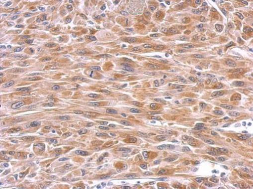 Anti-GPX8 antibody used in IHC (Formalin-fixed paraffin-embedded sections). GTX125992