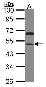 Anti-GRINL1A antibody used in Western blot. GTX106522