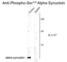 Anti-alpha Synuclein (phospho Ser129) antibody used in Western blot. GTX82738