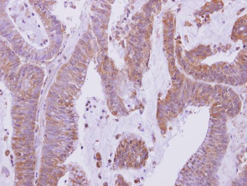 Anti-GS1 antibody used in IHC (Formalin-fixed paraffin-embedded sections). GTX115073