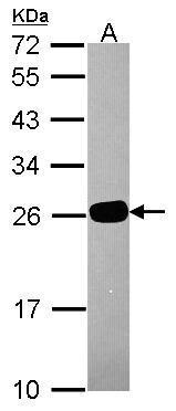 Anti-GS1 antibody used in Western blot. GTX115073