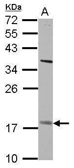 Anti-GS2 antibody used in Western blot. GTX102734