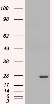 Anti-GST3 / GSTP1 antibody, Internal used in Western blot. GTX89536