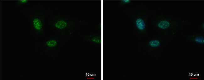 Anti-GSX2 antibody used in ICC/IF. GTX129390