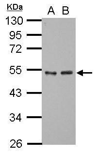 Anti-GTF2A1 antibody used in Western blot. GTX117420