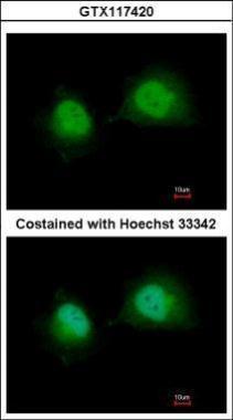 Anti-GTF2A1 antibody used in ICC/IF. GTX117420