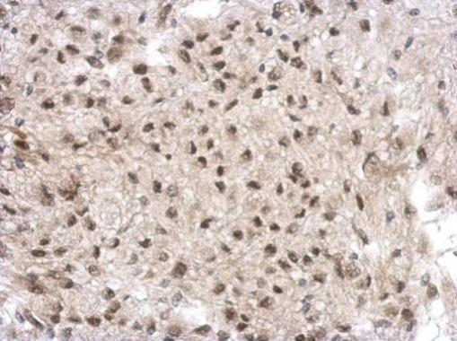 Anti-GTF2A1 antibody used in IHC (Formalin-fixed paraffin-embedded sections). GTX117420
