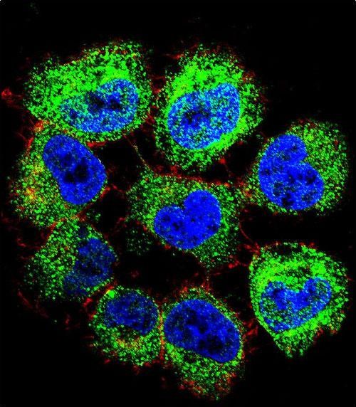 Anti-GTF2H2C antibody used in ICC/IF. GTX53544