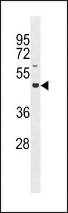 Anti-GXYLT2 antibody used in Western blot. GTX53588