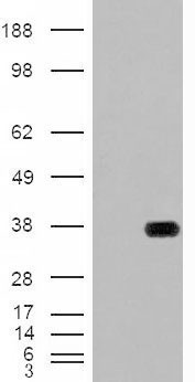 Anti-HADH / HADHSC antibody, Internal used in Western blot. GTX88923