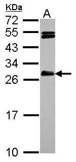 Anti-HAUS2 antibody [N1C3] used in Western blot. GTX118696