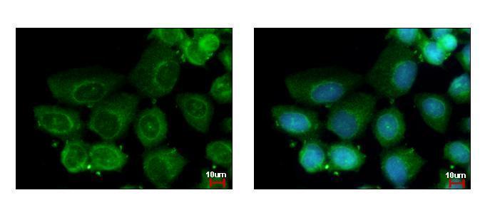 Anti-HAUS2 antibody [N1C3-2] used in ICC/IF. GTX118734