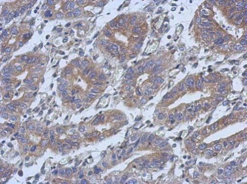 Anti-HAUS4 antibody used in IHC (Formalin-fixed paraffin-embedded sections). GTX106731
