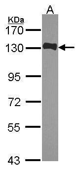 Anti-HAUS6 antibody used in Western blot. GTX118732
