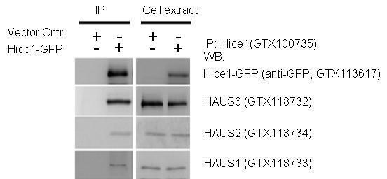 Anti-HAUS6 antibody used in Western blot. GTX118732