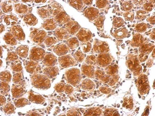 Anti-HAUS6 antibody used in IHC (Formalin-fixed paraffin-embedded sections). GTX118732