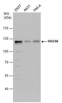 Anti-HAUS6 antibody used in Western blot. GTX118732