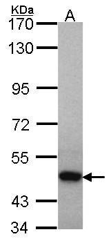 Anti-HCA67  antibody [C3], C-term used in Western blot. GTX107691