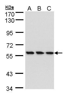 Anti-HCE antibody [N1N3] used in Western blot. GTX105694