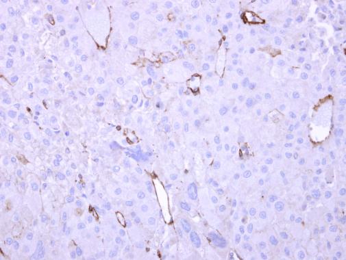 Anti-HECA antibody [C1C3] used in IHC (Formalin-fixed paraffin-embedded sections). GTX119157